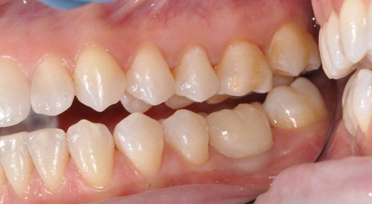 Digital Implant Course July 27-28  2018