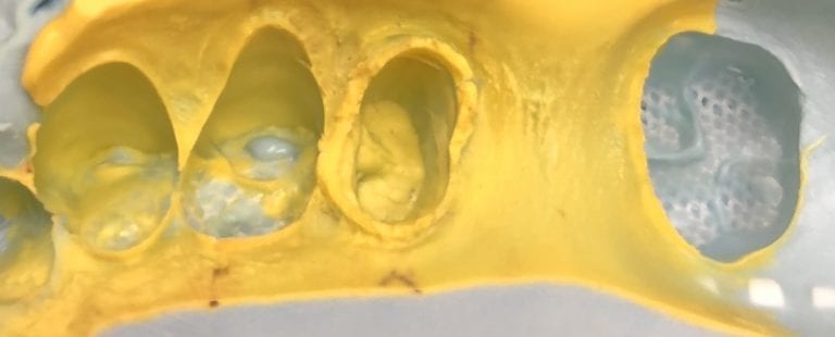 The most cost-effective way to get into digital dentistry!