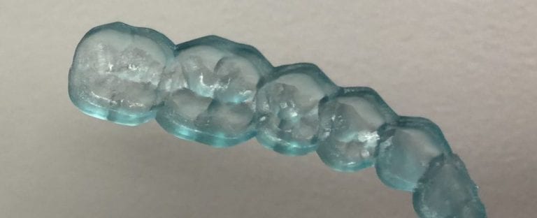 CAD-Ray Obstructive Sleep Apnea Device- Exclusively Printed by Burbank Dental Labs (Coming July 2018)