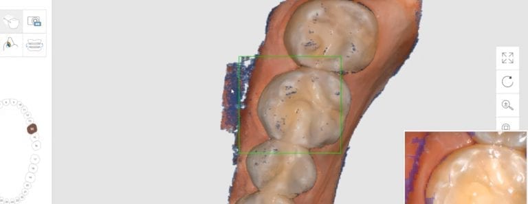 Full Arch Scan Strategy for Medit i500