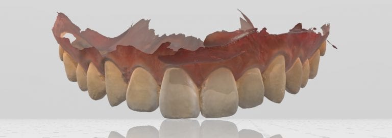 Different Model Trimming Methods with the Medit i500
