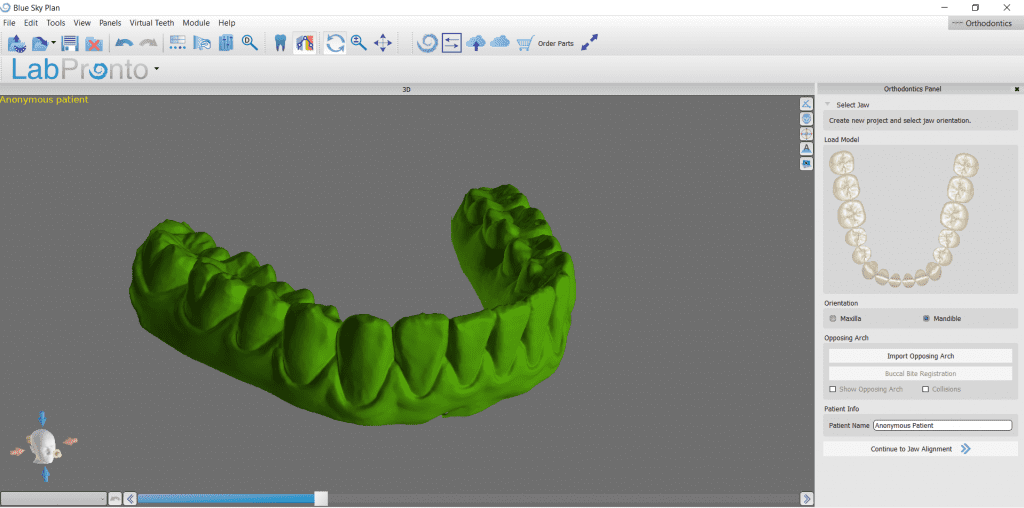 Full Arch Scan and Clear Orthodontic Retainer for Minor Tooth Movement