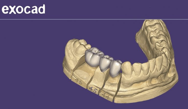 CAD-Ray is Now Officially a Reseller of the Exocad Software