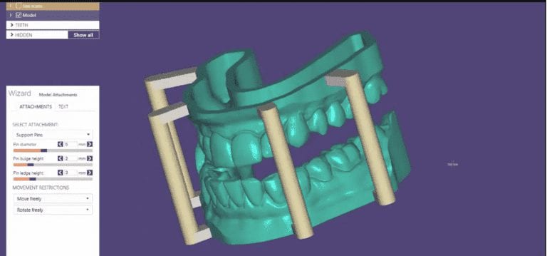 exocad Model Creator Add-On Module