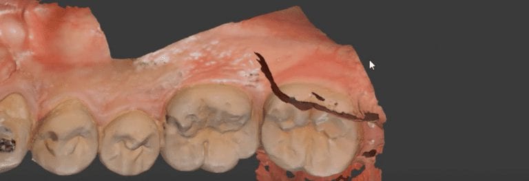 Inadvertent Data Capture of The Tongue and The Lip