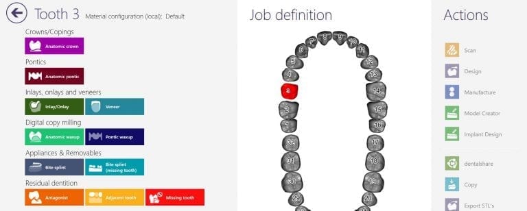CAD-Ray Design Software powered by exocad