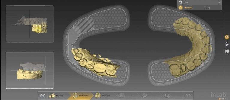 Image in Medit and Mill with CEREC