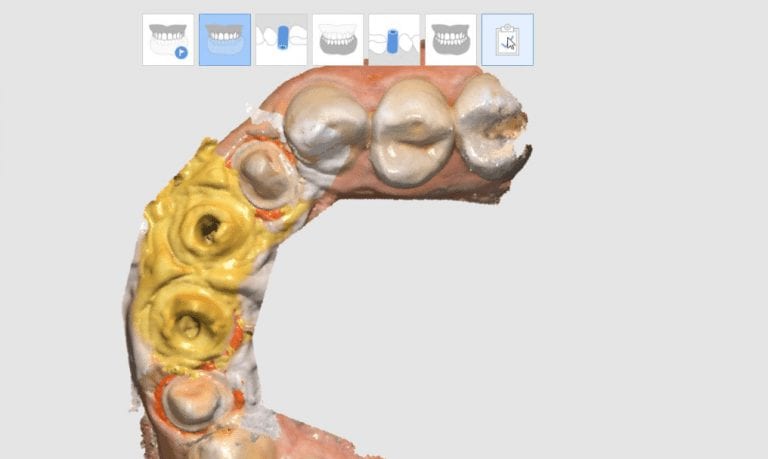 How Deep is Your Scan?