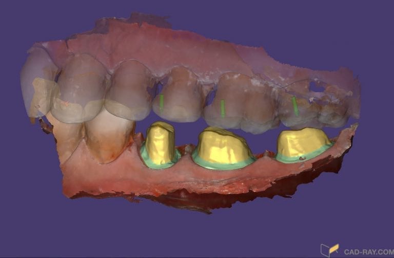 DentalShare: The Perfect Hand-Off from Dentist to Labs