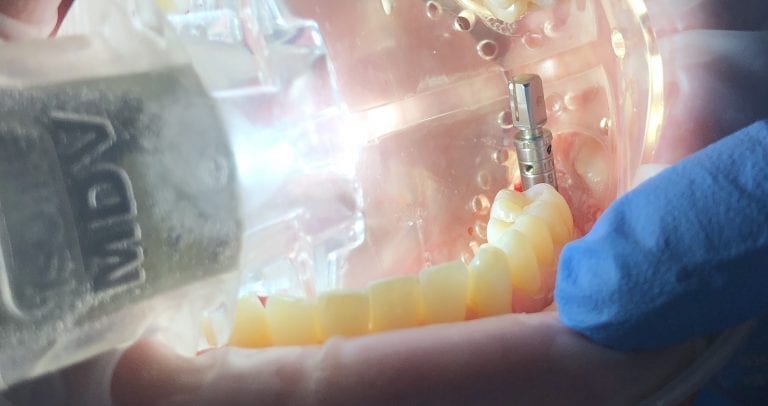 Perfectly Fits From Your Surgical Stents