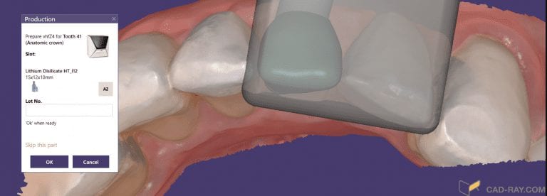 Milling A Lower Central Incisor in an eMax Size 12 Block on the VHF Z4 Milling Machine