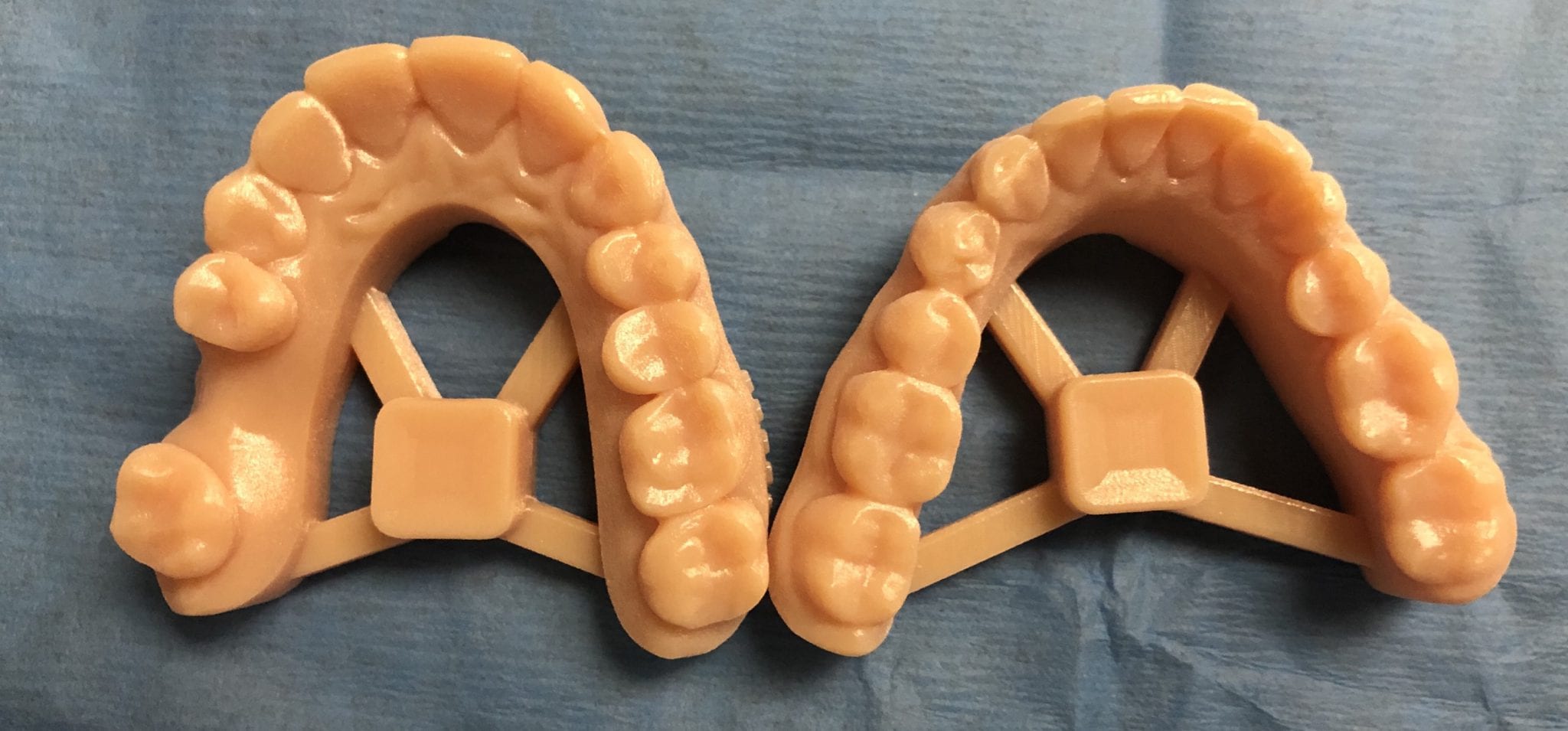 Print Quality is Very Important for Fabrication of Oral Appliances or ...