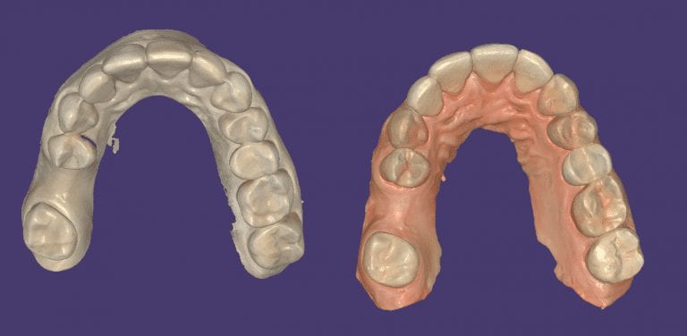 Print Quality is Very Important for Fabrication of Oral Appliances or Restorations