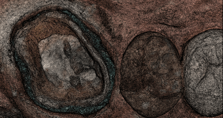 Local HD Scanning and Meshwork Difference with Medit i500