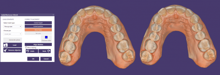 An Introductory Lesson on Accurately Relating Digital Dental Models to Each Other