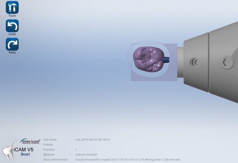 CORiTEC ONE For The Win! Under 15 Minutes to Mill an EMAX Molar Crown in a Size 14 Block (In Non-Detail Mode)