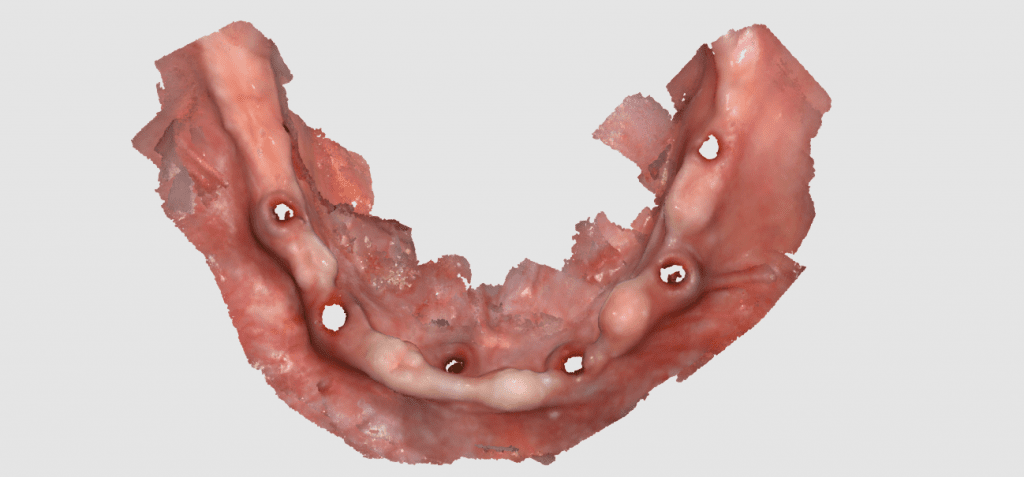 imaging an edentulous lower arch in dentistry