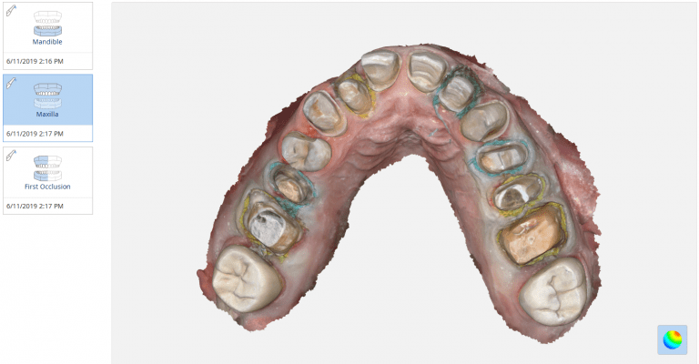 Smile Makeover For Advanced Users