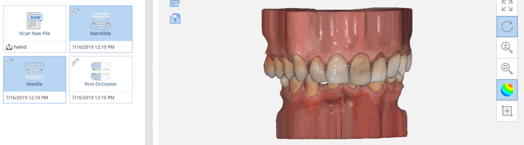 medit i500 adding a base to your models