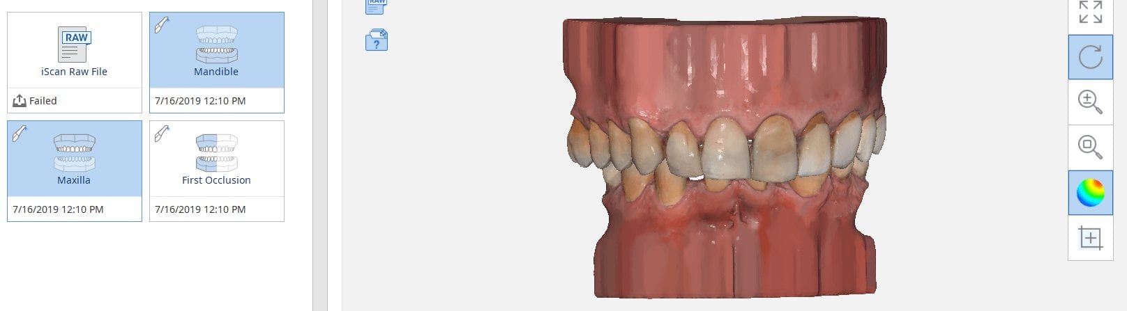 medit i500 adding a base to your models