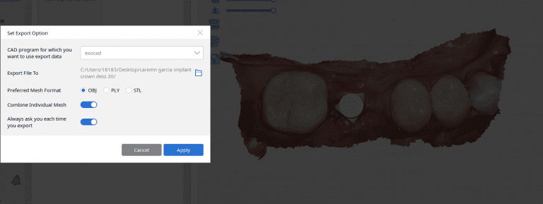 Combine Individual Meshworks for Scanbodies in Medit Version 2.1