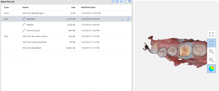 What are the Dental Project Files in exocad and Medit i500 Lab Software?