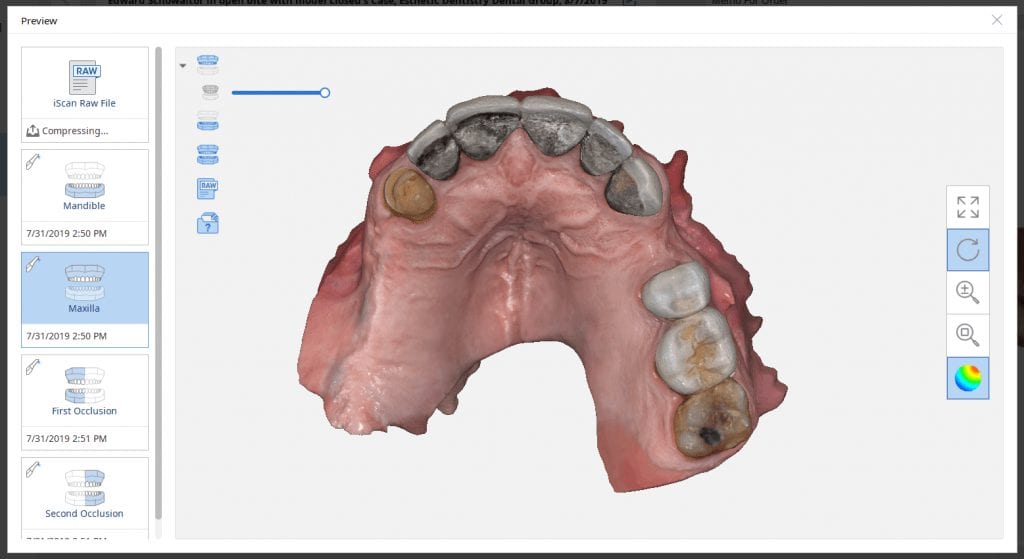 medit i500 full mouth reconstruction