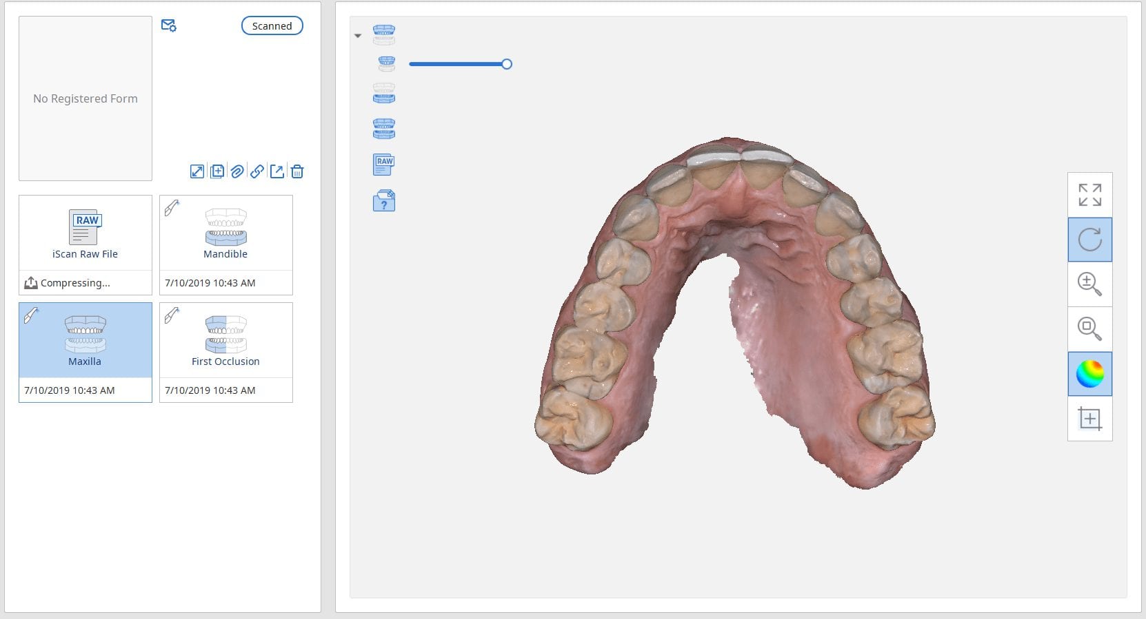 intraoral medit i500 scanner full arch imagery