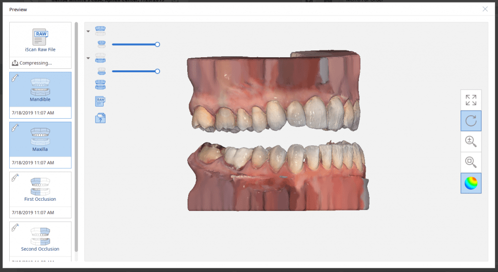 capturing multiple bites medit iscan software