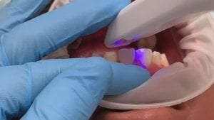 cross arch accuracy with Medit i500