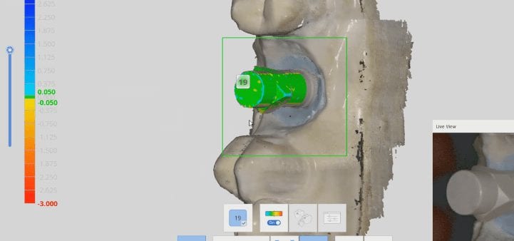 medit i500 scan body drop