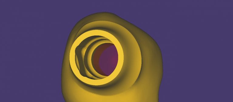 Problems Milling to a Tibase From a Scanbody Digital Impression ?