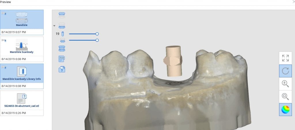 artificial intelligence medit i500 identifies location of your scanbody and automatically launches that information into CAD software