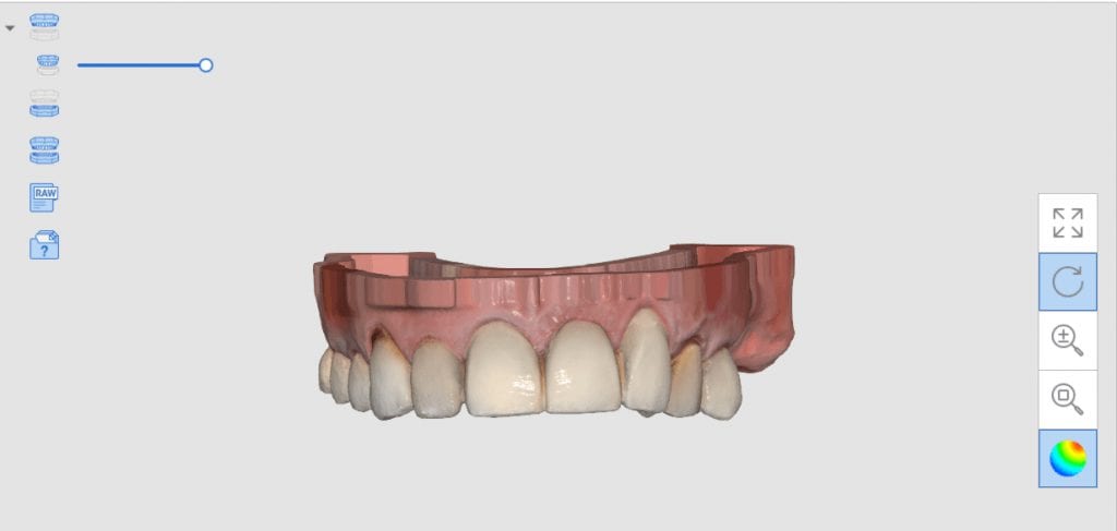 flat base that matches the occlusal plane of the arches