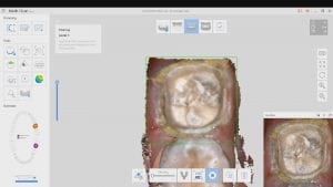 Medit i500 dental scanner