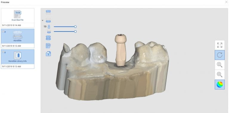 Medit i500’s Artificial Intelligence Custom Implant Identification Using The Analog Impression Abutment As A Scanbody