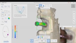 Medit i500 Intra-Oral Scanner artifical intellegent abutment identification system
