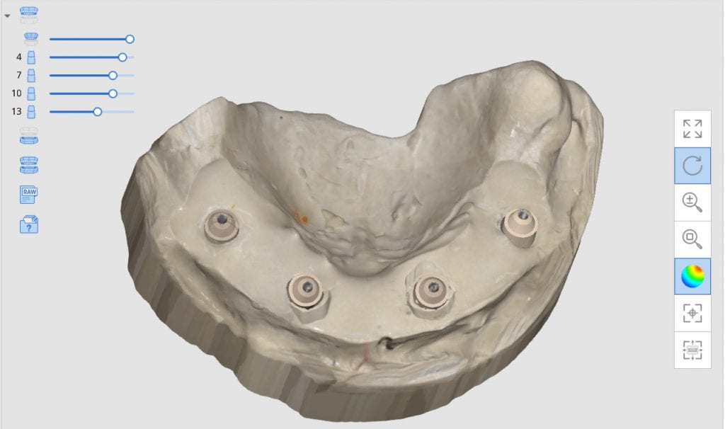 medit i500 artificial intellegent implant identification system