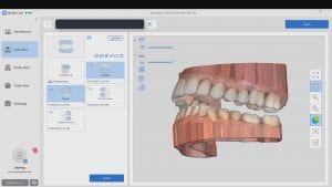 Medit i500 Intra-Oral Scanner allows for model processing with bases in native imaging software