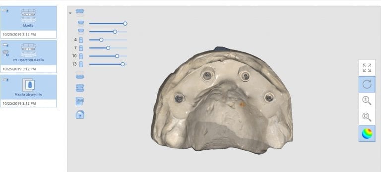 Live Intra-Oral Scan Verification Jigs for Full Arch Scans and Global Accuracy