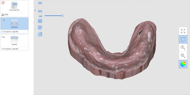 The Digital Pour Up- Creating a Base Model From a Digital Denture Duplication Scan
