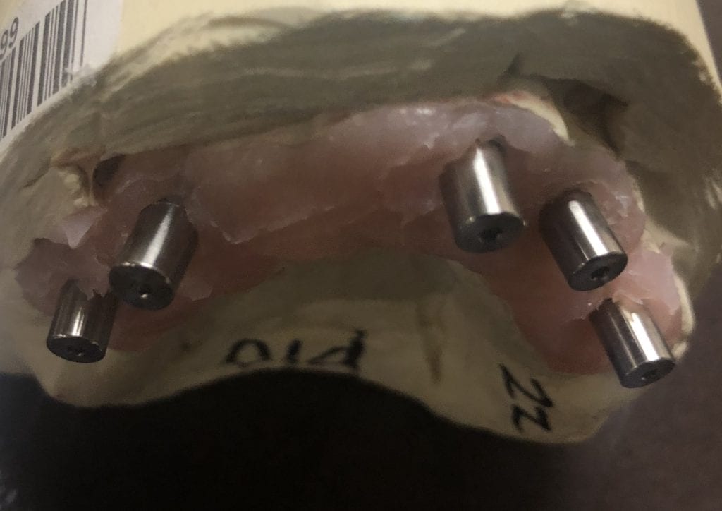 Artifical Intelligent Implant Suprastructure Identification System ...