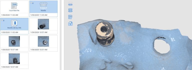 Hydroflouric Acid Etch Surface Treated Scanbody for Intra-Oral Scanning