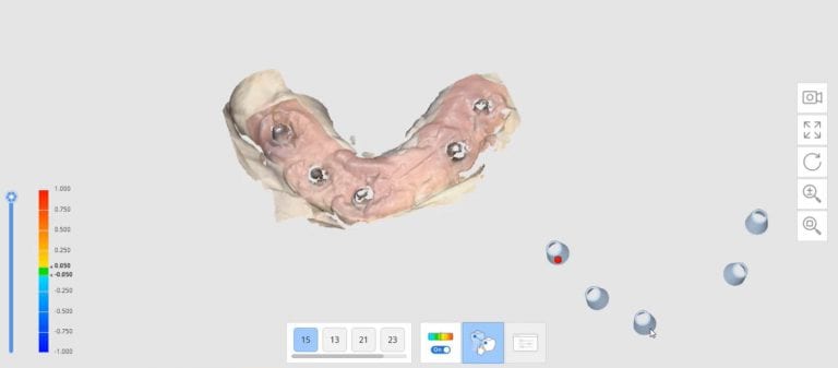 Imetric ICam 4D Photogrammetry Meets the Artificial Intelligence Implant Suprastructure By Medit i500