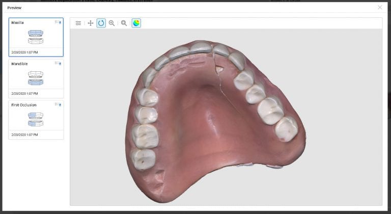 Digital Denture Duplication