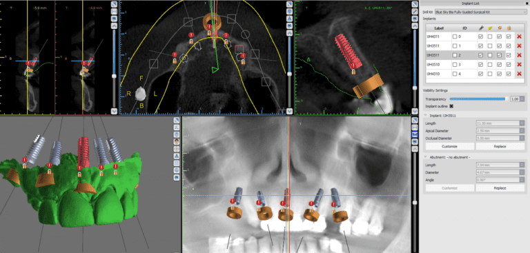 The Purpose of Technology For Dentists