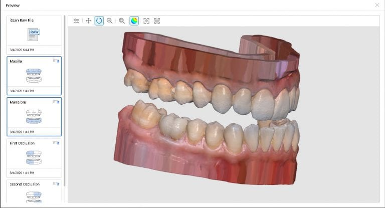 Mounting Upper and Lower Jaws for Obstructive Sleep Apnea Devices- Panthera