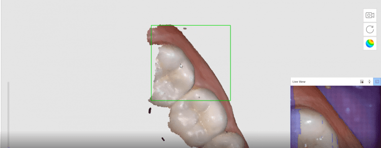 Where not to start with imaging with an intra-oral scanner