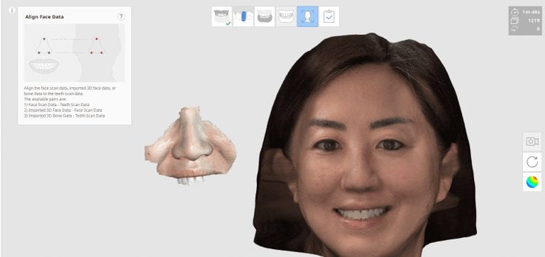 Intra-Oral Scan and Face Scan for Smile Analysis