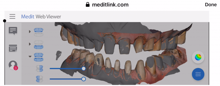 Medit User Crushes Full Arch Impressions After Watching Our Tutorials